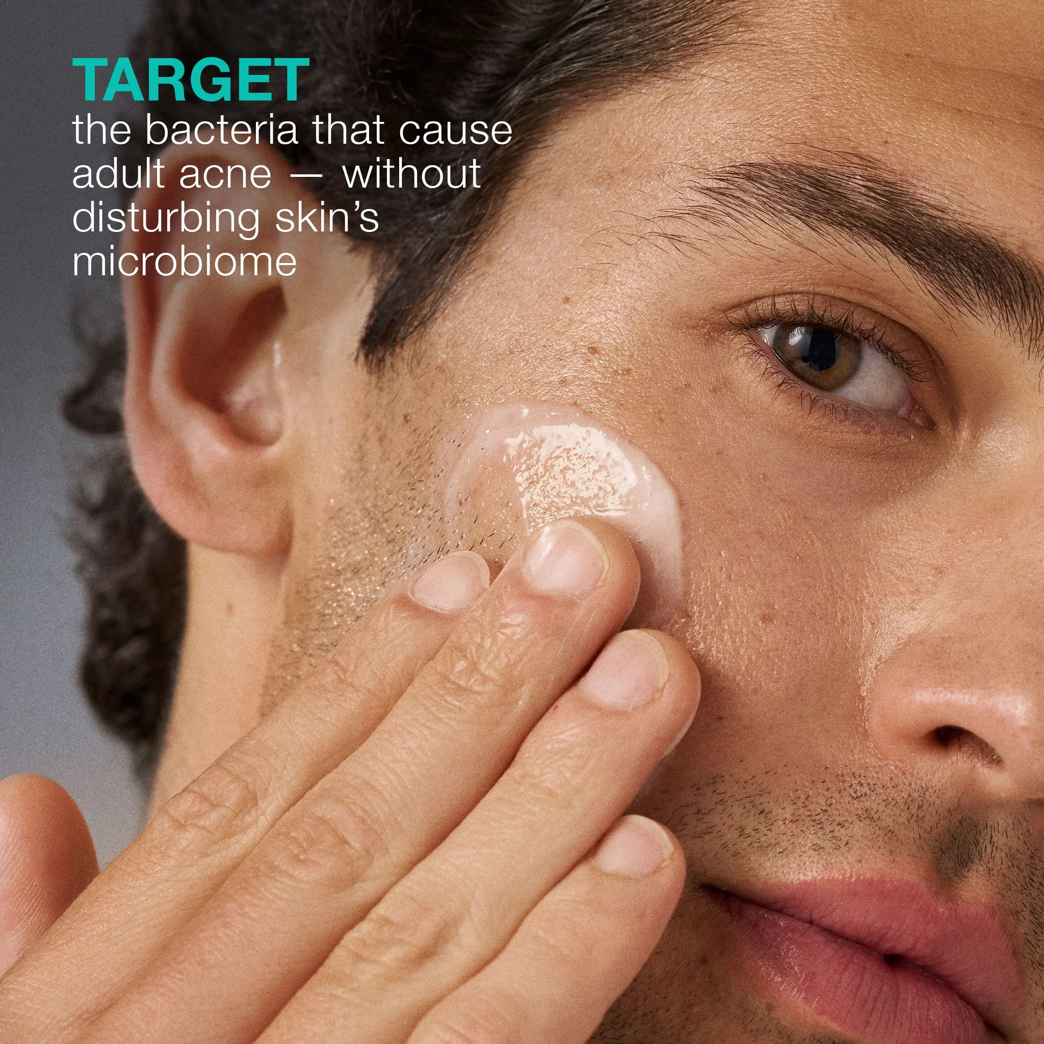 acne biotic moisturizer - Image 3