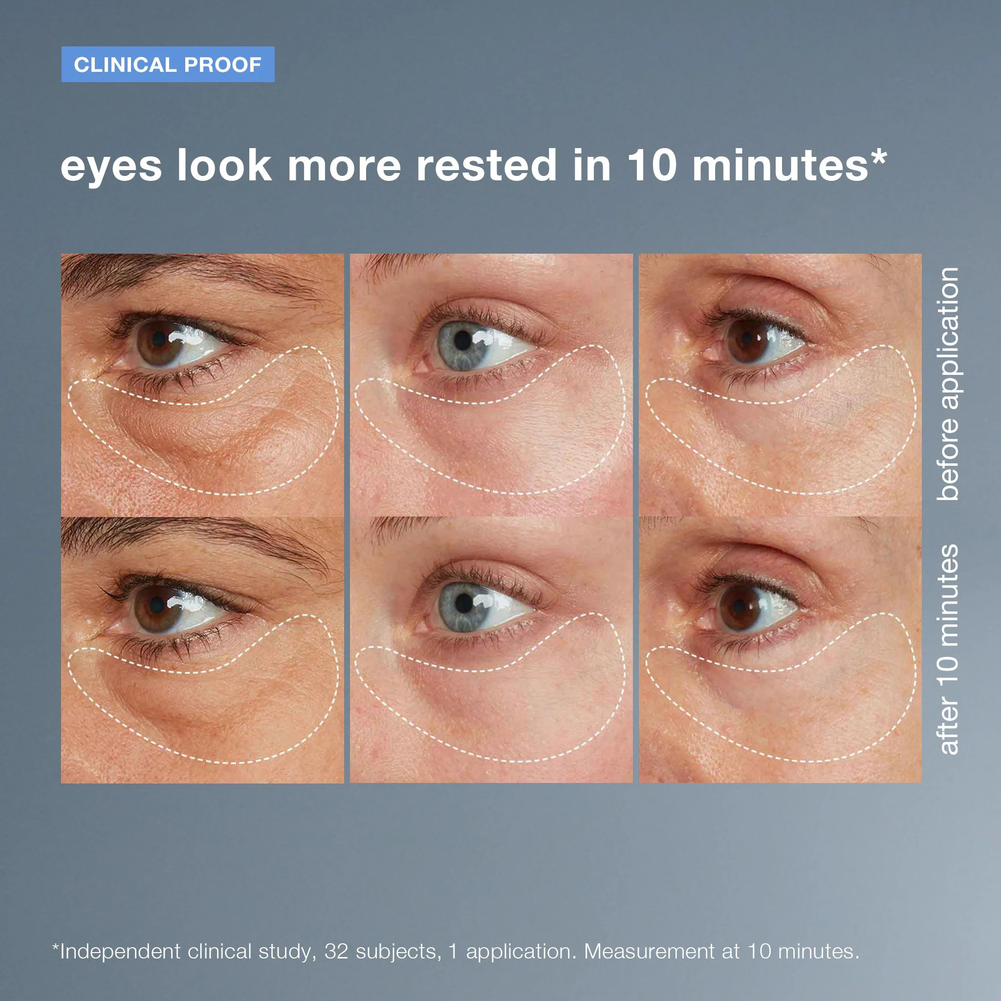 awaken peptide depuffing eye gel - Image 3