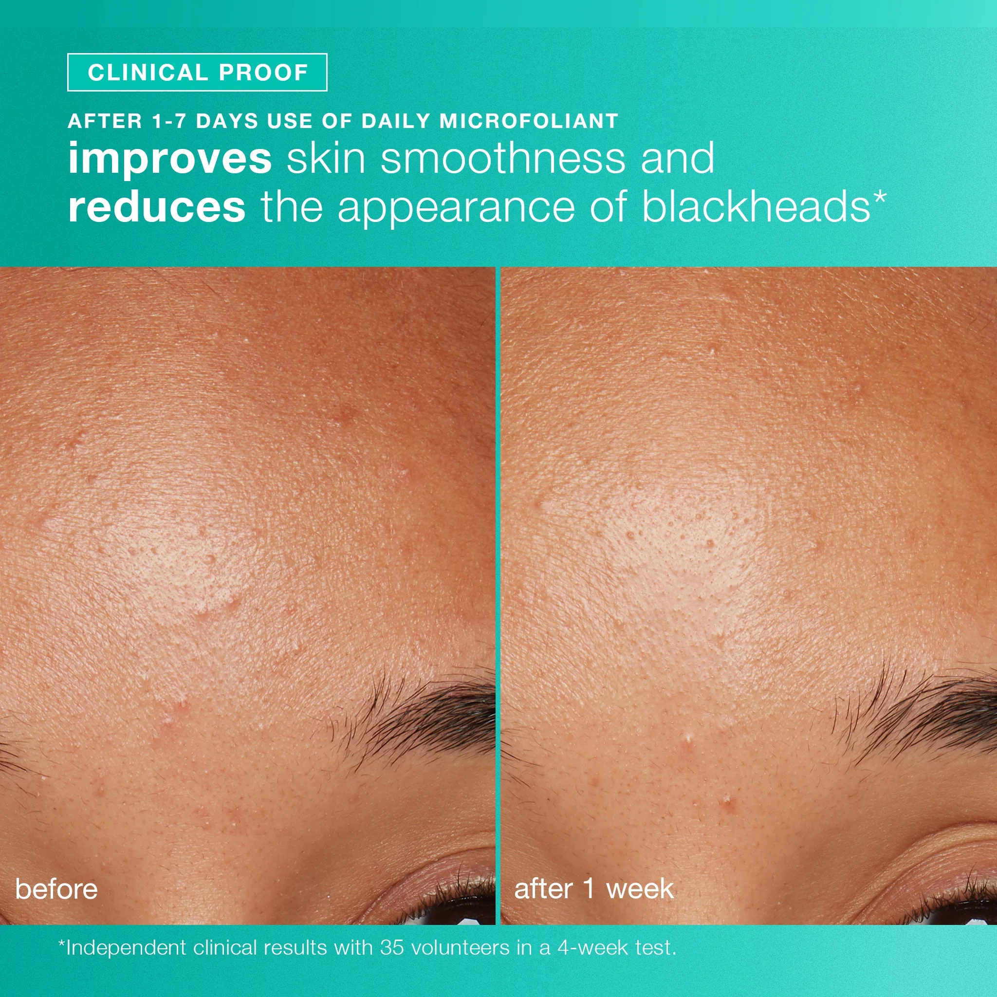 clear and brighten kit - Image 5