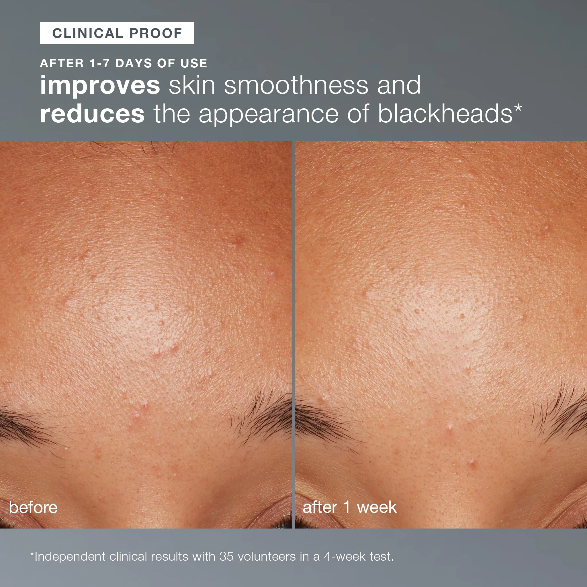 daily microfoliant exfoliator - Image 6