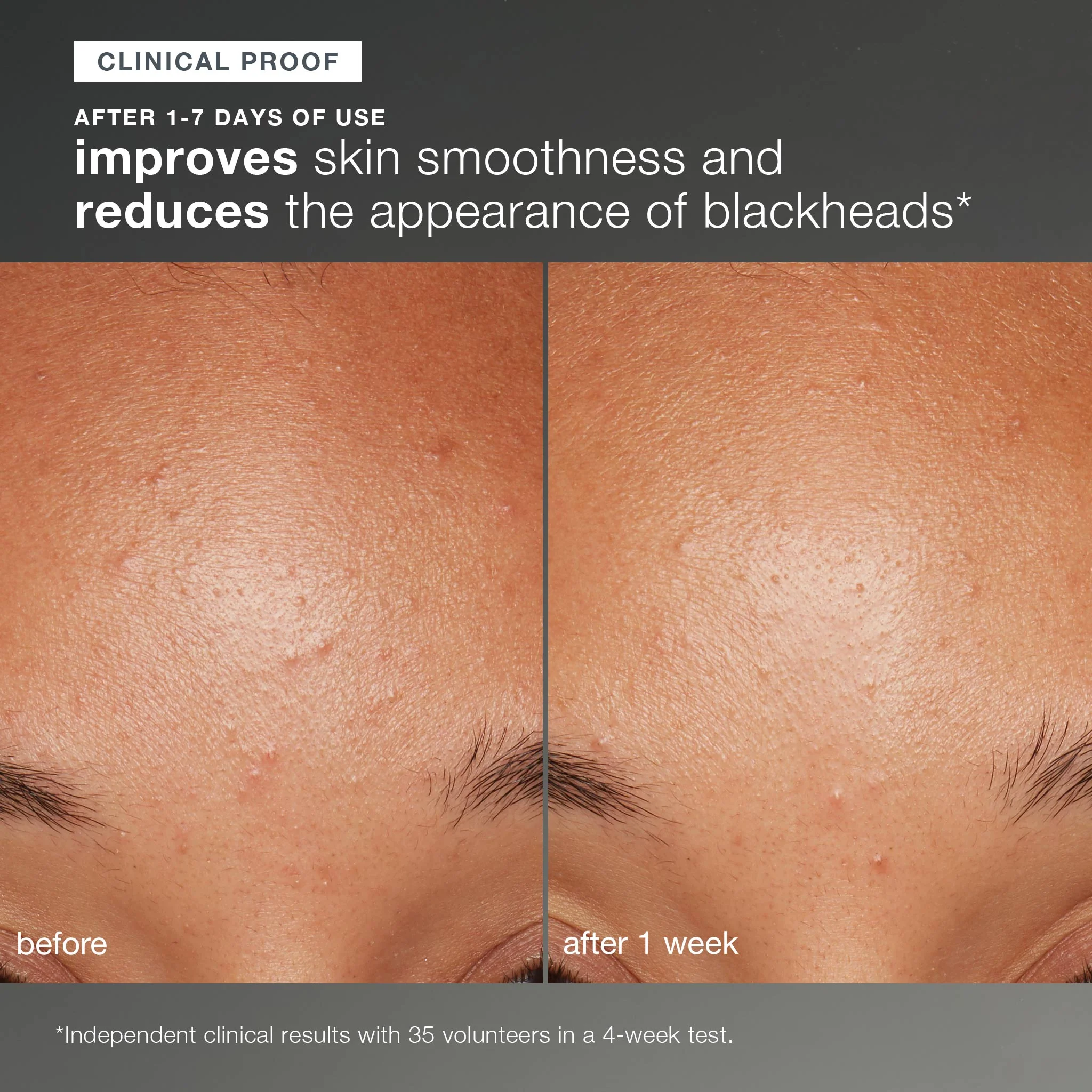 daily microfoliant exfoliator refill - Image 6