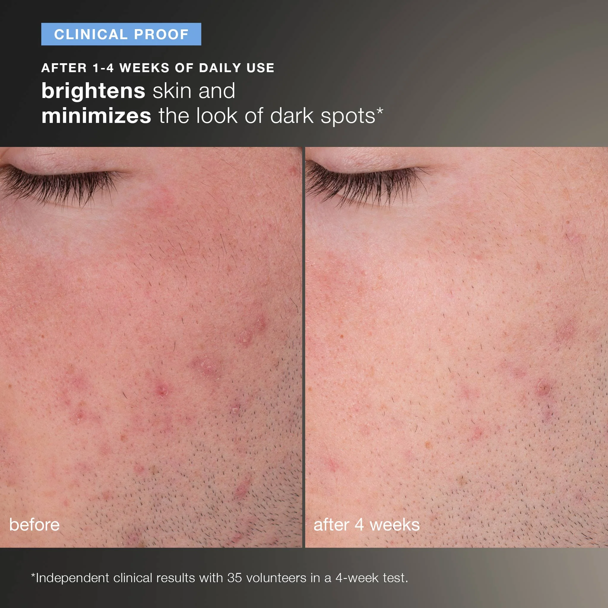 daily microfoliant exfoliator refill - Image 7