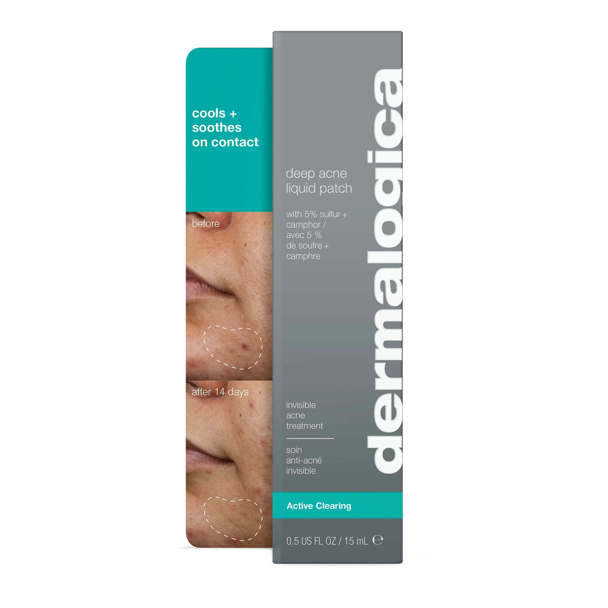 deep acne invisible liquid patch - Image 6