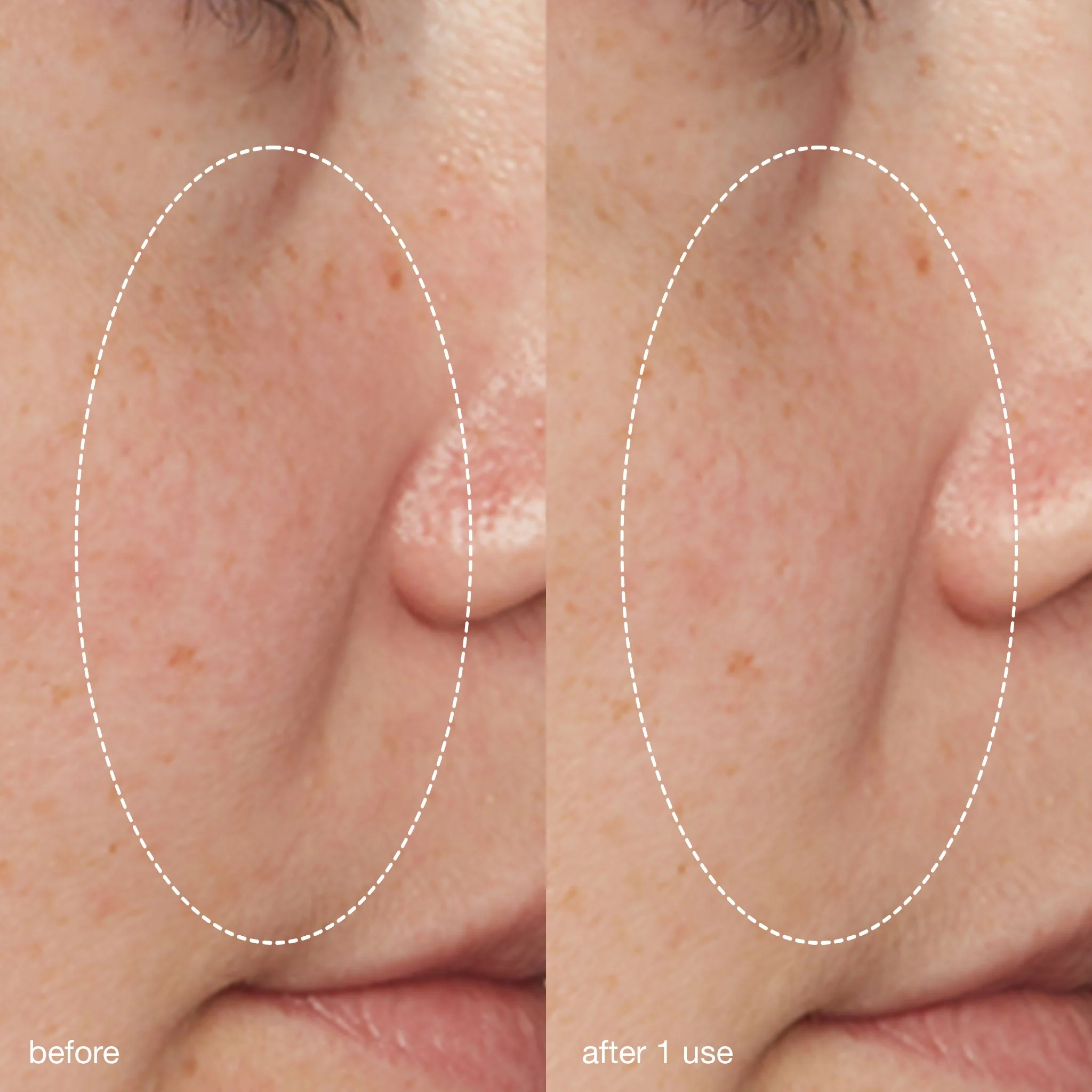 liquid peelfoliant - Image 8