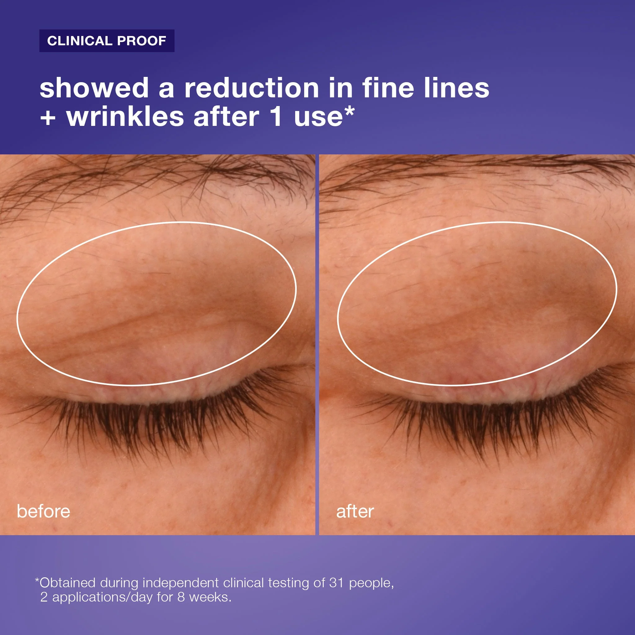 phyto nature lifting eye cream - Image 4