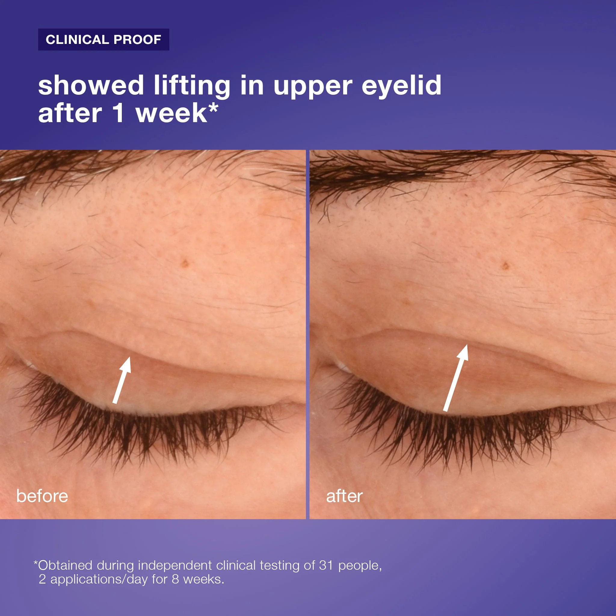 phyto nature lifting eye cream - Image 5