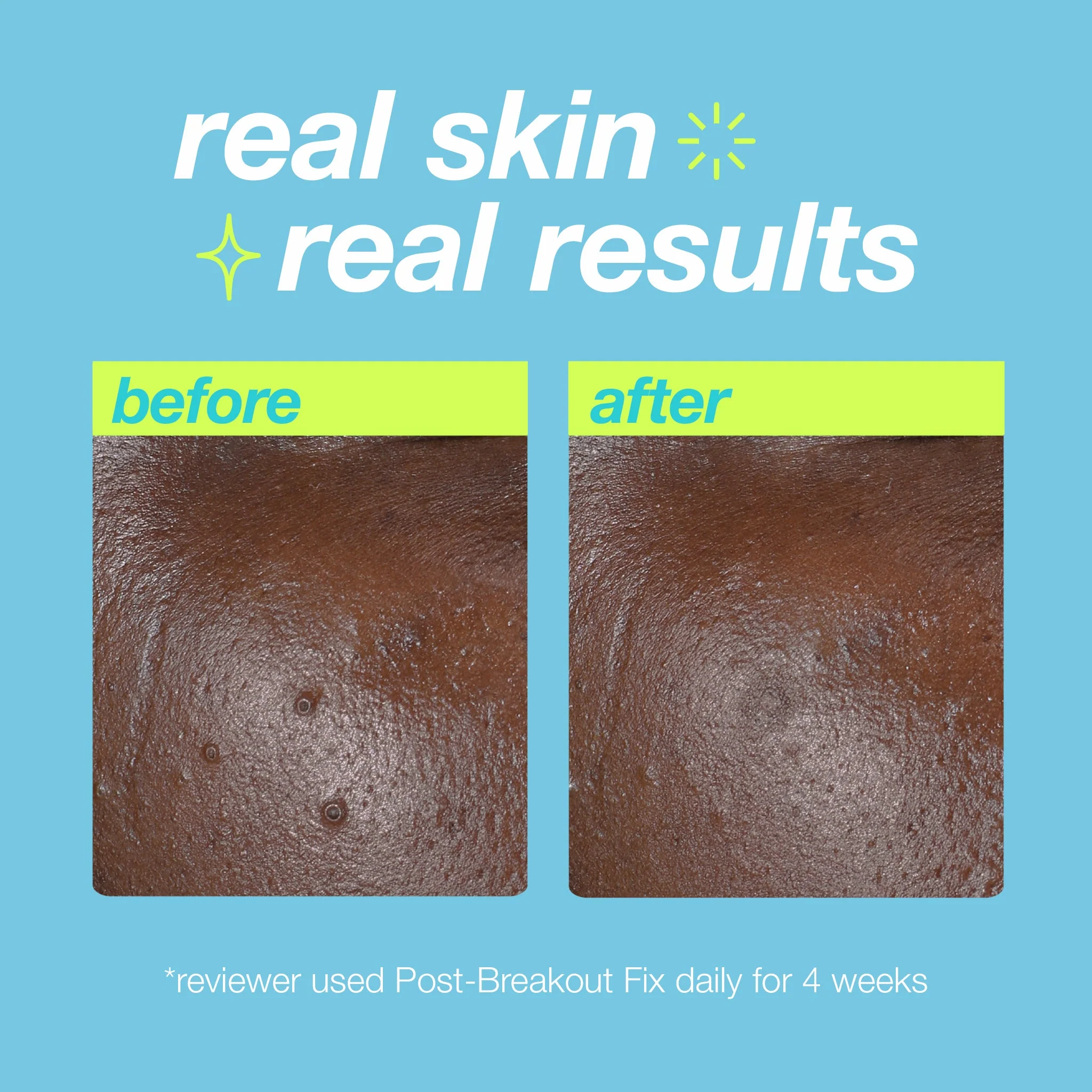 post-breakout fix - Image 6