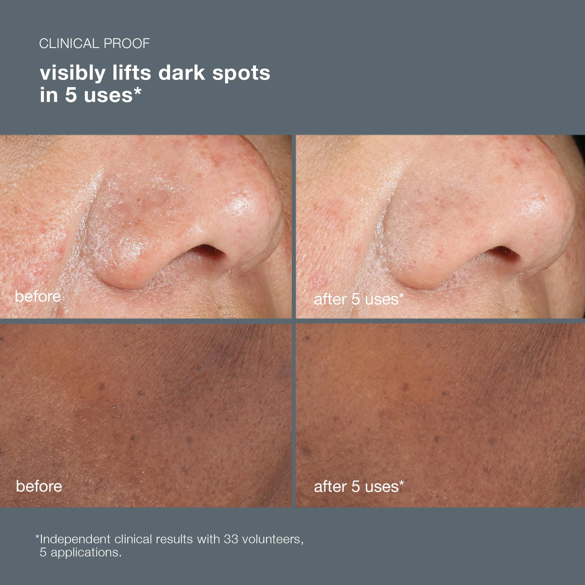 powerbright dark spot peel - Image 6