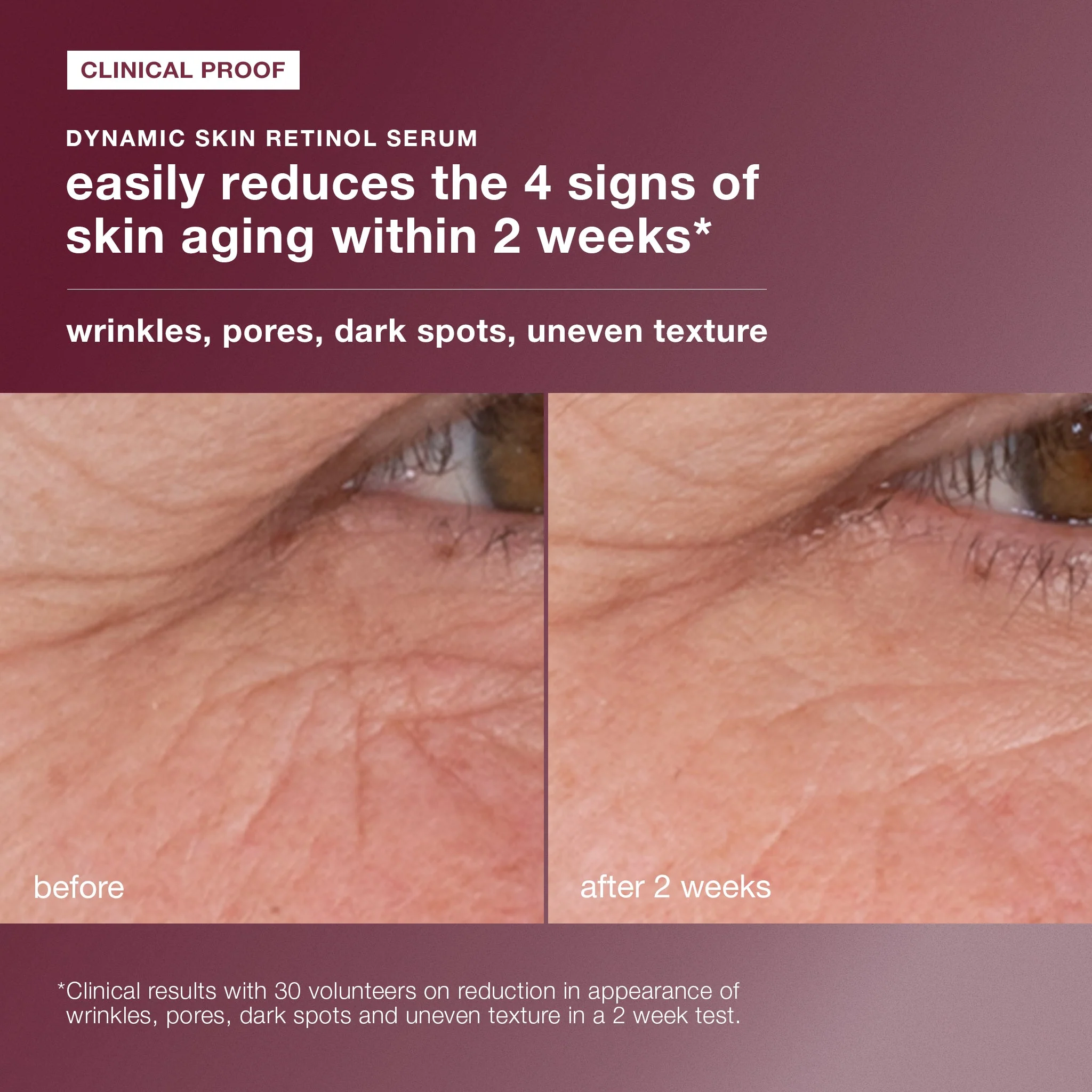 skin aging solutions kit - Image 5