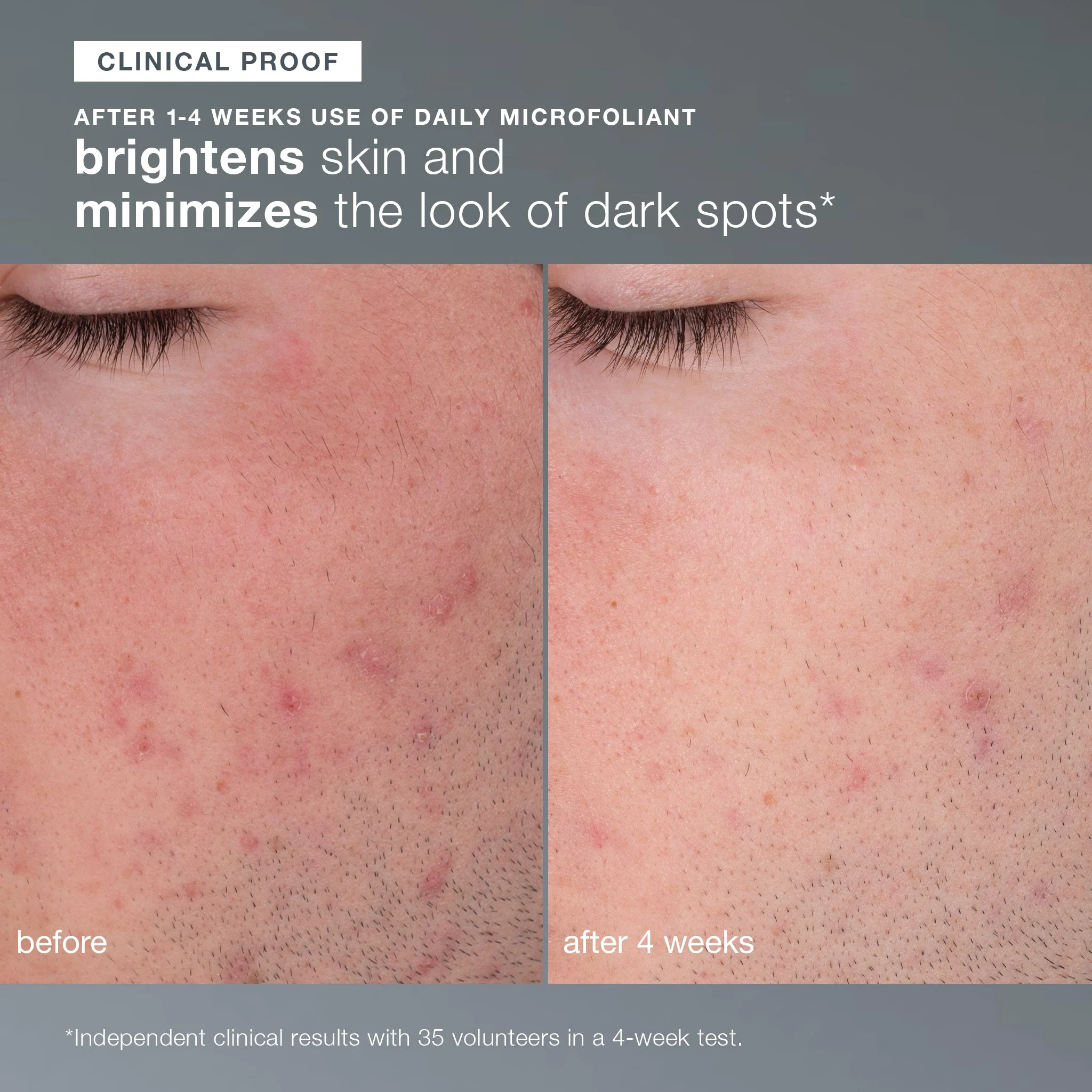 skin transformation duo - Image 5